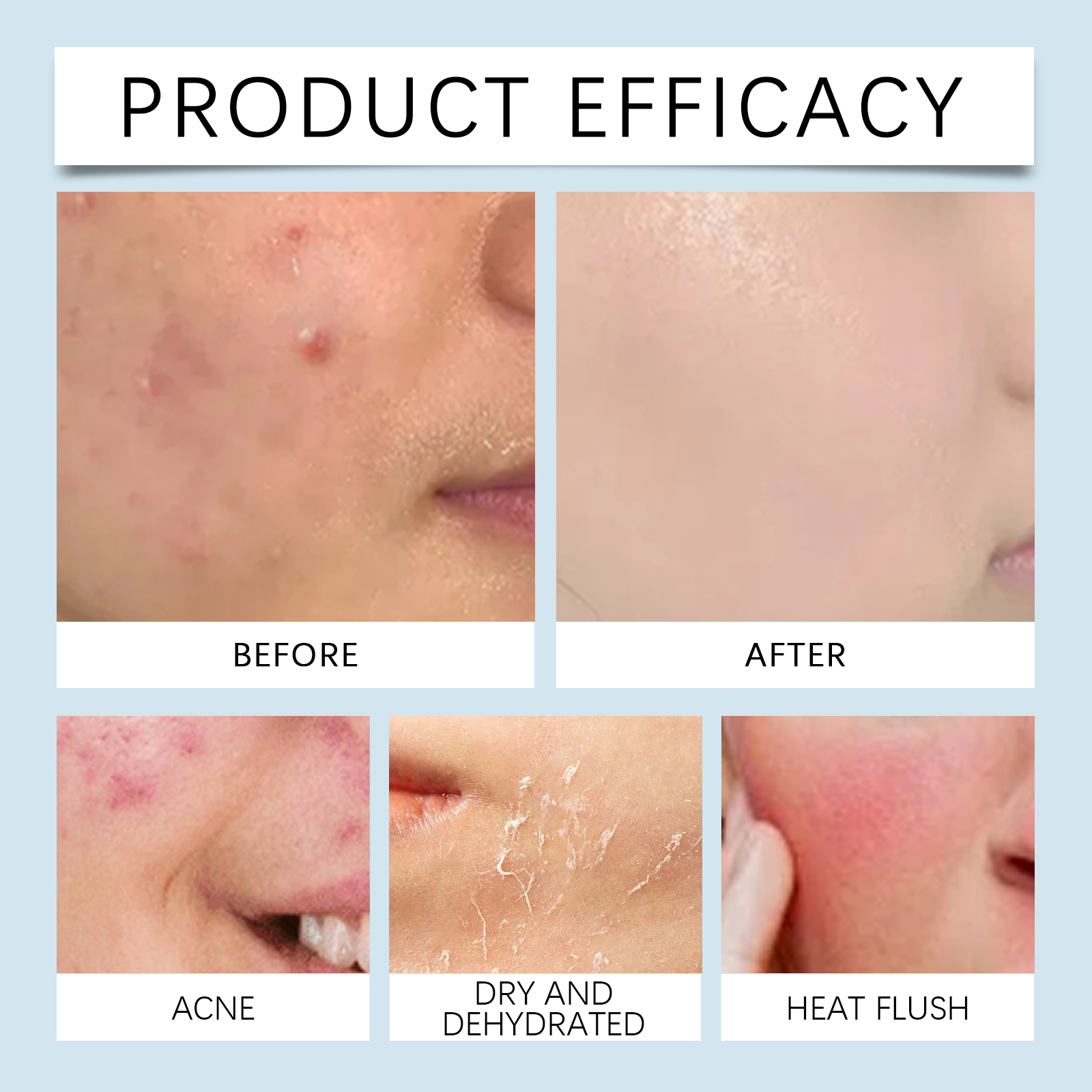 Hydrating roller Serum 0.25mm  - Luxury Skincare Collection reseña y precio